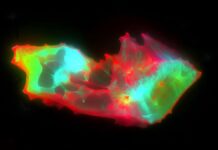 Приховані зміни крові можуть пояснити тривалі симптоми COVID