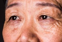 Studien deuten darauf hin, dass ein Rückgang des Sehvermögens Demenz über ein Jahrzehnt vor der Diagnose vorhersagen kann