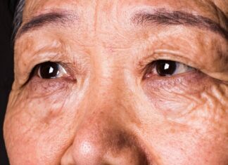 Зниження зору може бути ознакою деменції за десять років до встановлення діагнозу, йдеться в дослідженні