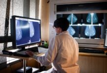 Las mamografías mejoradas con IA reducen el riesgo agresivo de cáncer de mama