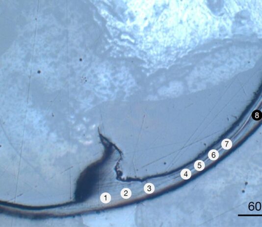 Why Bristle Worm Jaws Define a New Class of Material: The Bio-Metal Discovery